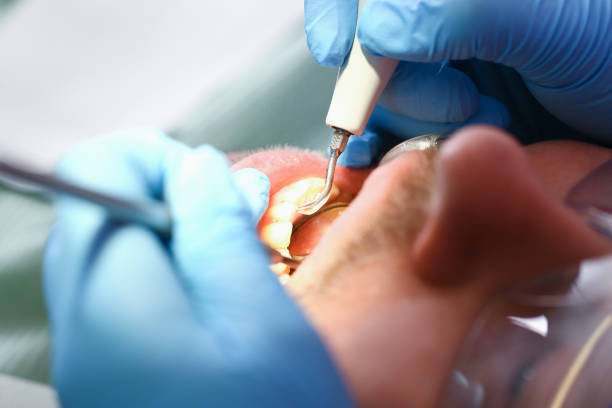 Best Tooth Pain Emergency Relief  in Skippers Corner, NC