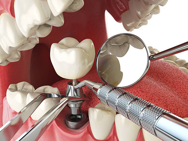 Best Cracked Tooth Emergency Dentist  in Skippers Corner, NC